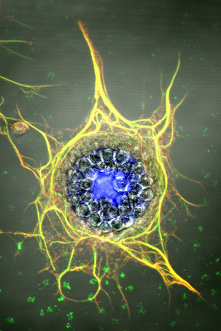 P10 PIBs Reza King cropa